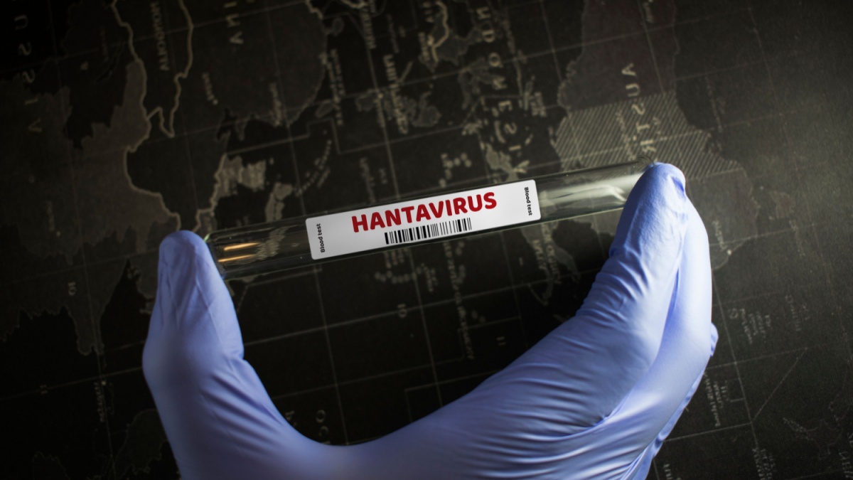 Mano con provetta e scritta Hantavirus
